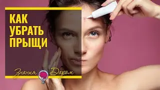 КАК БОРОТЬСЯ С АКНЕ