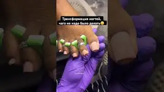 Антитренд на длинные ногти на ногах🫣 Нееужное наращивание… 