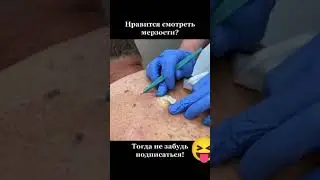 БОЛЬШОЙ ВЗРЫВ ЖИРОВИКА🤮