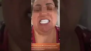 Виниры для Бедных: Когда Хочется Голливудскую Улыбку