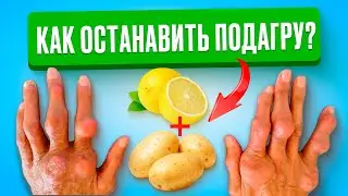 Смесь этих 2 продуктов мигом растворят КРИСТАЛЛЫ МОЧЕВОЙ КИСЛОТЫ. Продукты от ПОДАГРЫ и АРТРИТА