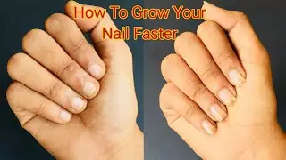 How to Grow your Nails Faster 💅|| Manicure At Home ❤️ #nail #manicure @Nail_shine