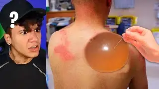 se você terminar esse vídeo você ganha R$10 mil reais no PIX !