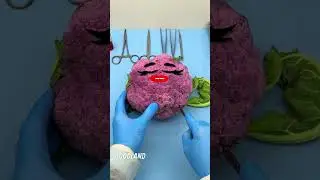 Goodland | Cauliflower surgery 😂 
