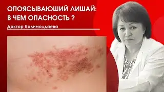 ОПОЯСЫВАЮЩИЙ ЛИШАЙ: В ЧЕМ ОПАСНОСТЬ?