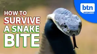 What To Do If You Get Bitten By A Snake