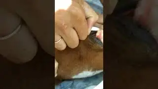 Кератоконъктивит. Удаление катаракты