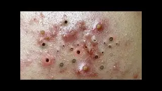 Relaxing Everyday With Loan Nguyen Skincare
