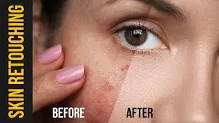 Create a Skin Retouching Dodge, Burn and Frequency Separation in Photoshop | Skin Retouching