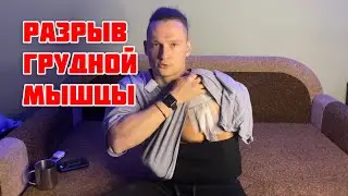 Разрыв грудной мышцы, отрыв грудного сухожилья. Личный опыт: первая неделя после операции.