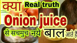 Onion juice for hair growth || क्या Onion juice से नय बाल आते हैं [hindi] #tannudada