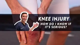 How do I know if my knee injury is serious?