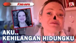 AKU KEHILANGAN HIDUNGKU...