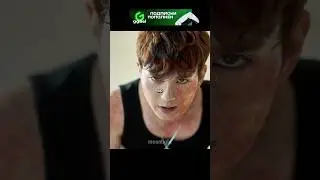 АЛЛЕРГИЯ НА ЛЮДЕЙ😱 