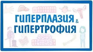 ГИПЕРПЛАЗИЯ И ГИПЕРТРОФИЯ