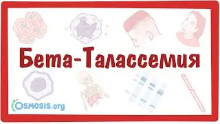 Бета-Талассемия — причины, симптомы, патогенез, диагностика, лечение