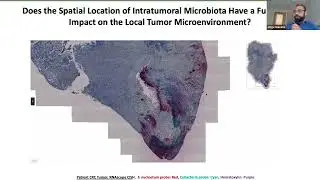 [Jorge Galeano]Effect of the intratumoral microbiota on spatial and cellular heterogeneity in cancer