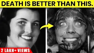 What was Lobotomy? Most Dangerous Surgeries ever performed | RAAAZ ft. @eeshamalkani1655