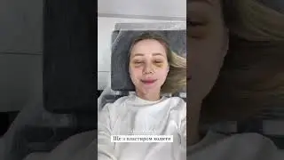 Дружина Віктора Павліка показала, як змінилася після ринопластики