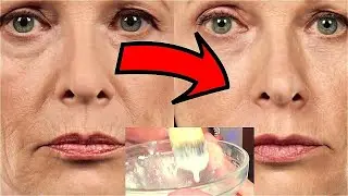HUMIDIFIER OF AIR AND FACIAL SKIN for rejuvenation from wrinkles