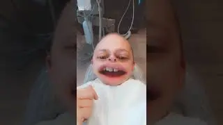 Snapchat, The dentist drugged me