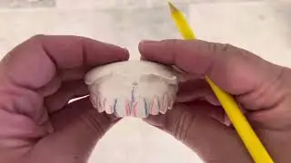 5 Surfaces of each tooth