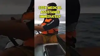 Shark attacks, stop the bleeding 