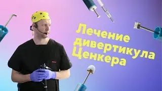 ENDO QURILTAY 2024. Эндоскопическое лечение дивертикула Ценкера