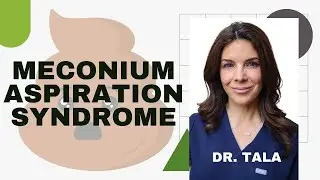 Meconium Aspiration Syndrome - Tala Talks NICU