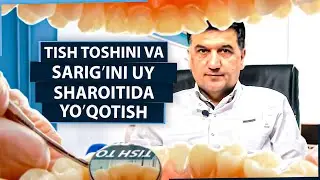 Tish toshlari zararlimi ? Tish negа sаrgʼаyadi?