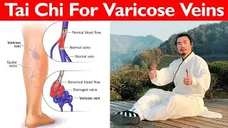 How To Relieve Varicose Veins  |  Tai Chi Movements to Alleviate Varicose Veins