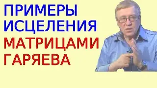 Примеры исцеления матрицами Гаряева. Редкое интервью академика (фрагменты)