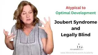 Atypical Development Baby 2 years old Joubert Syndrome and Legally Blind