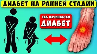 Так начинается диабет, первые звоночки! 10 признаков высокого сахара, 90% даже НЕ ЗНАЮТ, что у них