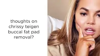 Chrissy Teigen got buccal fat pad removal. Not sure it was the right move.