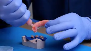 Placing the Denture for Pickup - Smart Denture Conversions Training