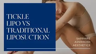 Tickle Lipo vs Traditional Liposuction