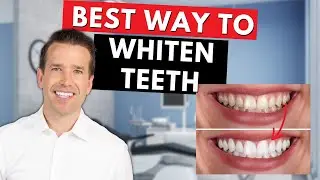 Why Your Teeth are Yellow | How to fix Stained teeth🦷