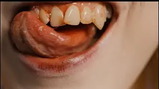 Signs of tooth pain that tell you that decay has reached the pulp of the tooth