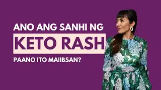 Ano ang Sanhi ng Keto Rash? Paano Maiibsan?