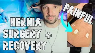 I Had Surgery! - Laparoscopic Inguinal Hernia Repair Surgery