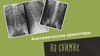 Анатомические ориентиры на снимке