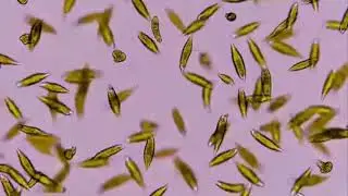 Microscopic Examination Of Some Algae
