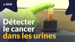 Cancer de la vessie : dépister via un test urinaire ? | Reportage