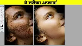 How to remove facial pimples in photoshop |चेहरे के पिंपल्स कैसे हटाये |How to remove facial pimples