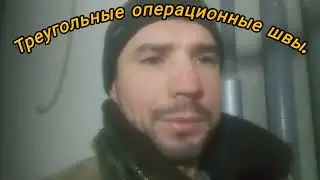 треугольные операционные швы.