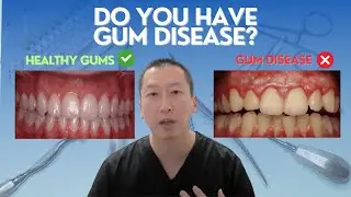 Gum Disease:  What you need to know before treatment!