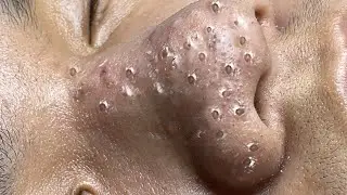 Relaxing Everyday With Loan Nguyen Skincare
