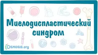Миелодиспластический синдром (МДС) — причины, симптомы, патогенез, диагностика, лечение