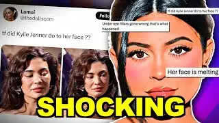 WHAT HAPPENED TO KYLIE JENNER?!